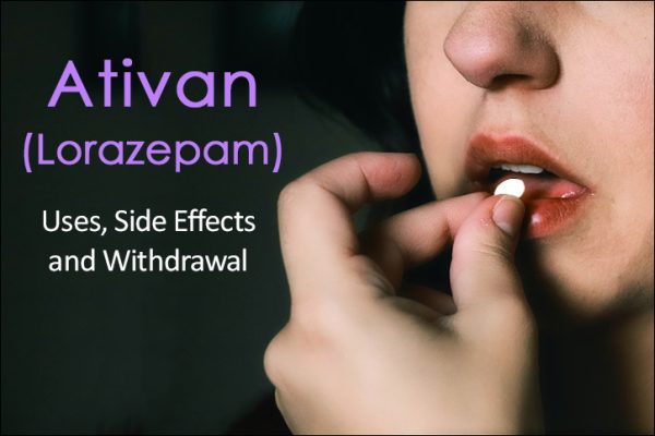 Precautions to take before and after you buy Lorazepam online